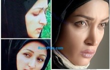 عکسی از بازیگر زن قبل و بعد از عمل زیبایی!